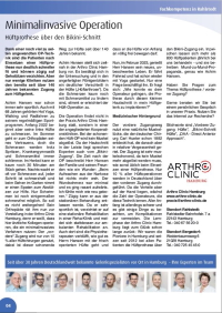 Artikel zum thema Hüftprothese minimalinvasiver Zugang